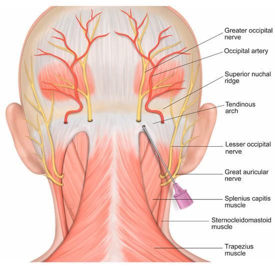 02-550 Stop Back-Of-The-Head Headaches Now: Proven Remedies & Tips